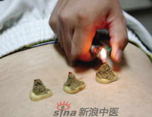 灸法的種類(lèi)  你知道多少？
