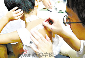灸法的種類(lèi)  你知道多少？