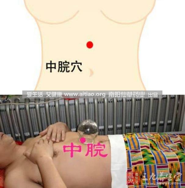 中脘穴位于腹部正中線(xiàn)，臍上4寸的位置上。每天艾灸10-15分鐘，能有效緩解胃部不適的癥狀，同時(shí)有助于祛濕。
